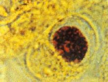 クラミジアトラコマチス ページ [1] 世界百科事典の知識